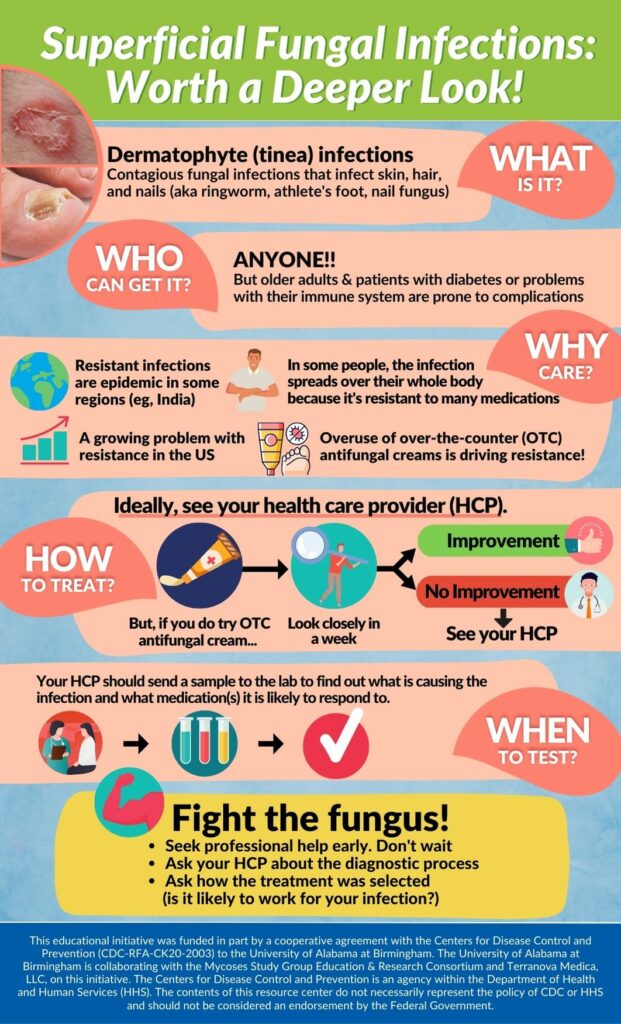 Superficial Fungal Infection Handout - Fungus Education Hub